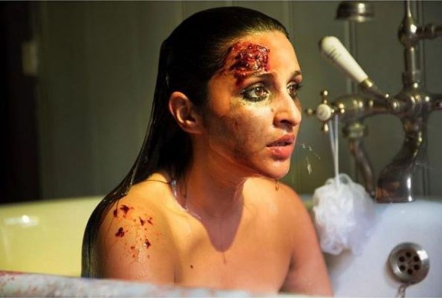 Parineeti shares bruised avatar from 'The Girl On The Train'
